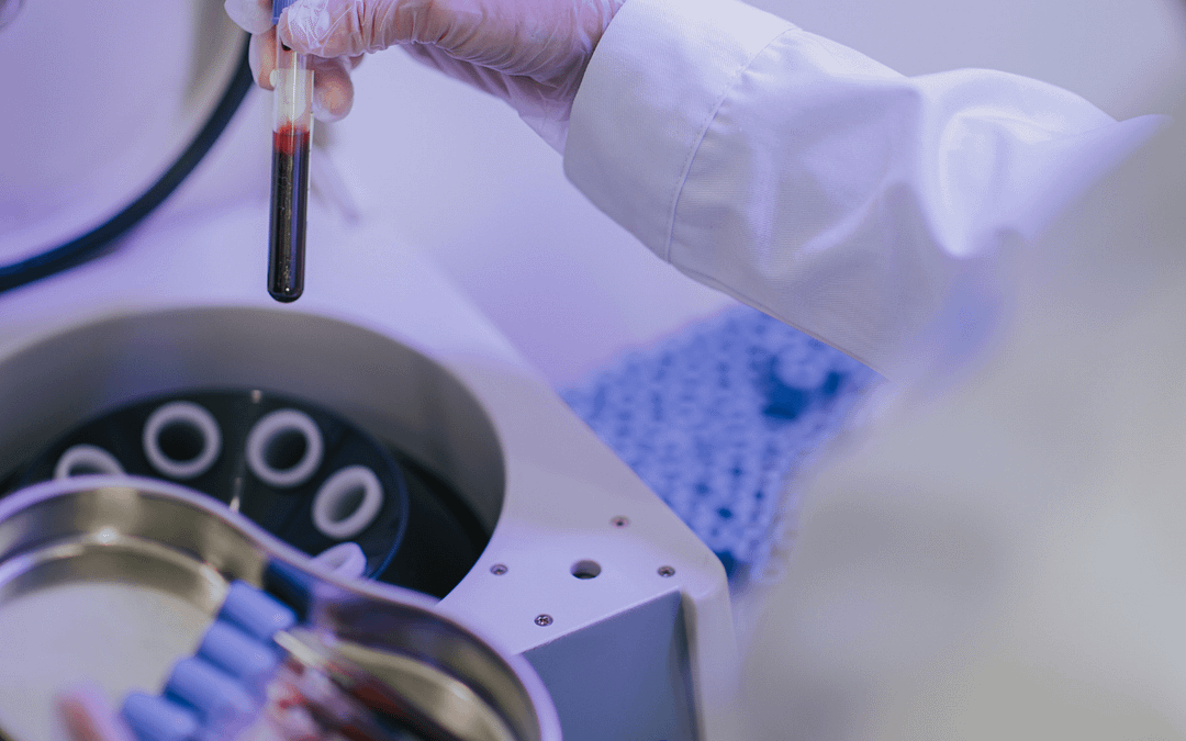 doctor with blood tubes for prp therapy