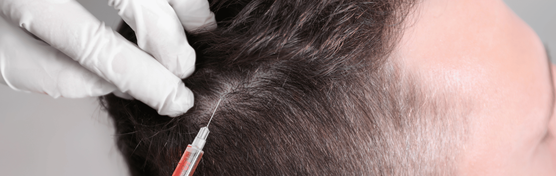 close up female receiving eye rejuvenation treatment