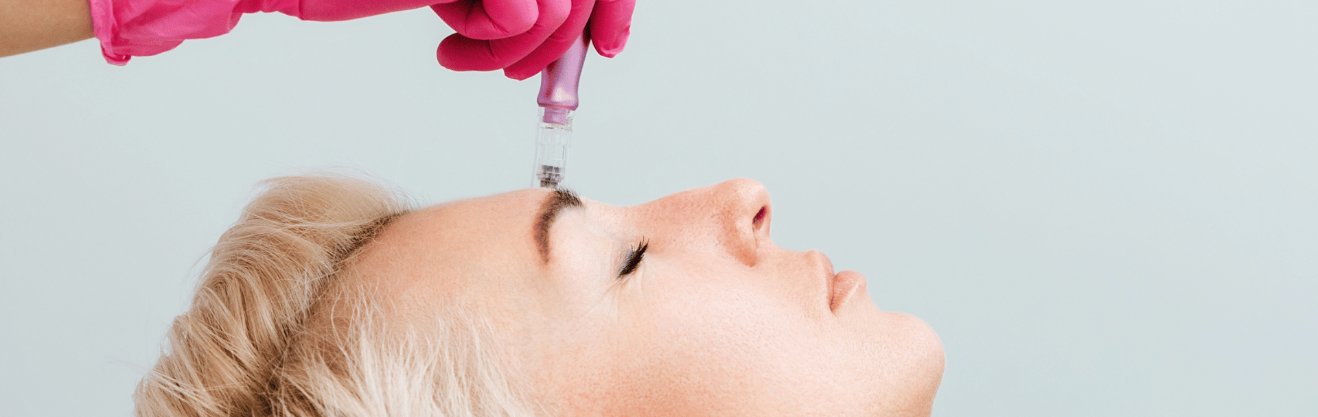 female patient receiving microneedling treatment