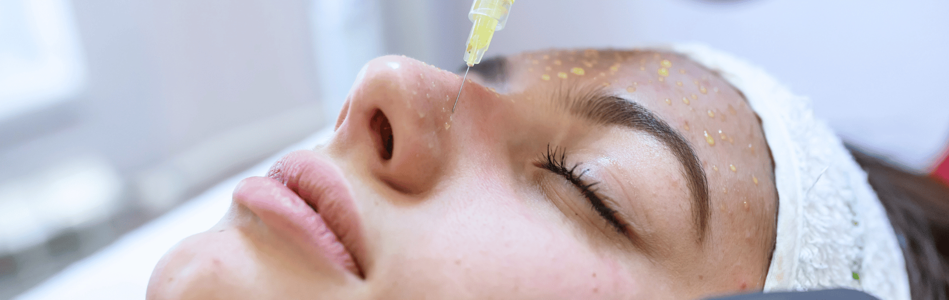 Patient receiving skin boosters treatment