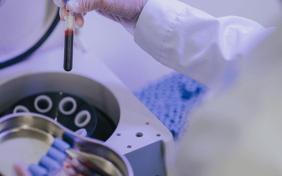 PRP Therapy Explained: How Platelet-Rich Plasma Can Transform Your Skin